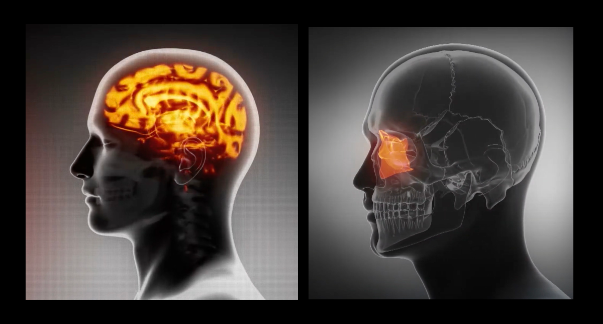 Scientists Develop AI Algorithms To Analyze Enormous Datasets In Alzheimer's Research