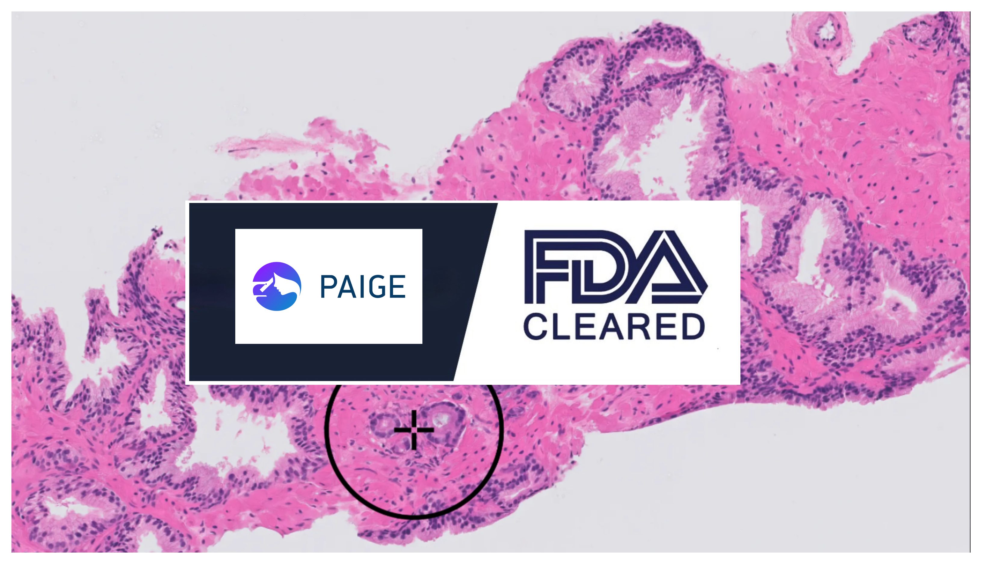 FDA Grants Approval For AI-Based Pathology Product For The First Time